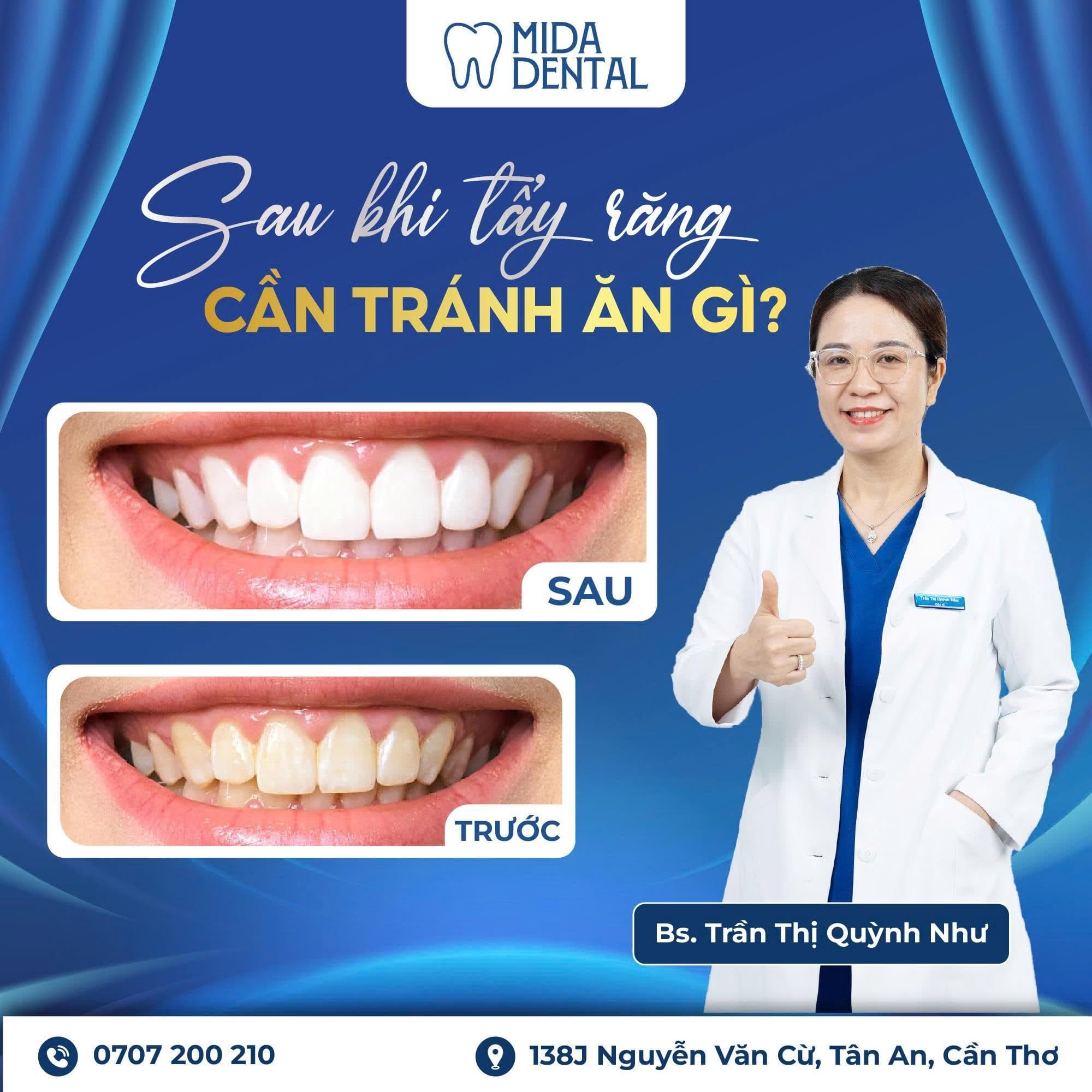 Sau khi tẩy răng, cần tránh ăn gì?